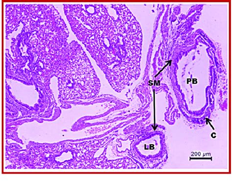 Histological section of the lung showing principal (PB) and lobar ...