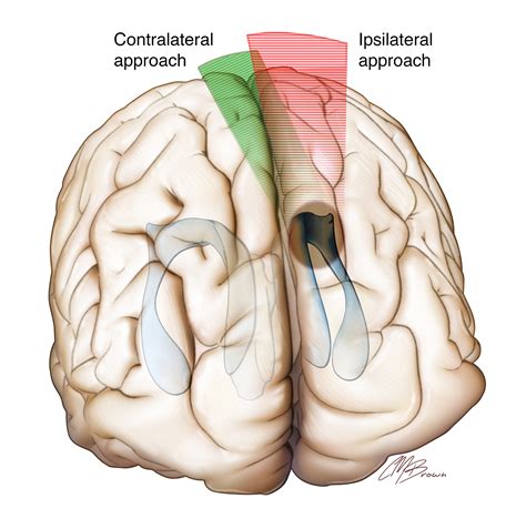 Lobes And Fissures Of The Brain