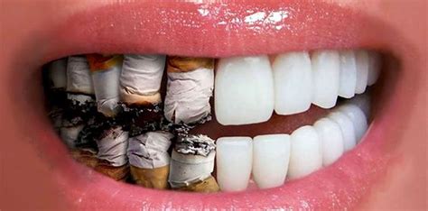 Smoking and Gum Disease: What You Should Know – Britten Perio