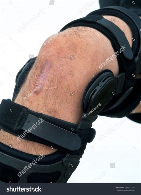 Knee Brace For Acl Football Knee Injury. Stock Photo 167127185 : Shutterstock