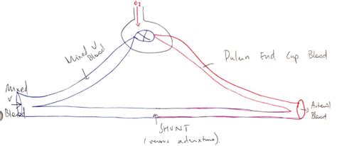 F6v: Explain the concept of shunt, its physiological effects, and its measurement – Jenny's Jam Jar