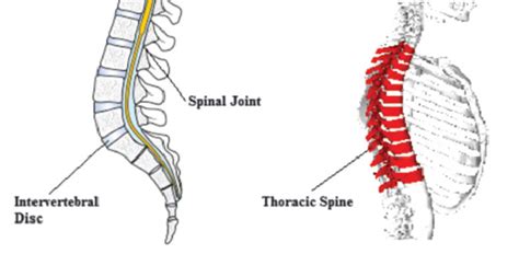 Tuberculosis of Spine - Dr. K S Mane | Spine Surgeon