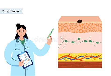 Biopsy Procedure Stock Illustrations – 370 Biopsy Procedure Stock ...