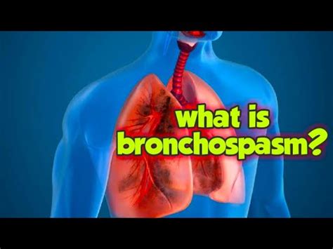 what is bronchospasm??cause, symptoms.. - YouTube