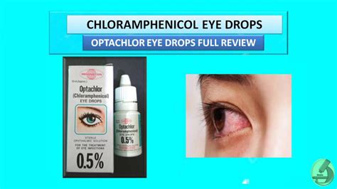 Chloramphenicol Eye Drops | Optachlor Eye Drops Full Review - YouTube