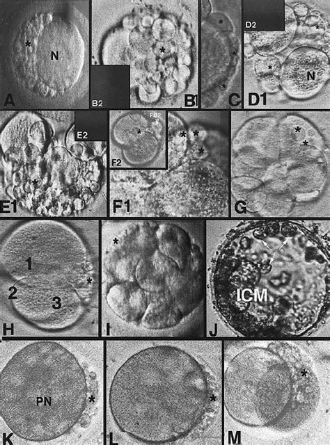 Egg Cell Division Microscope