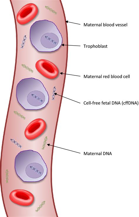 Cell‐free fetal DNA‐based noninvasive prenatal testing of aneuploidy - Mackie - 2017 - The ...