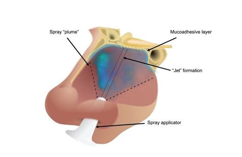 Nasal spray that protects against COVID-19 ‘ready for use’ in humans ...