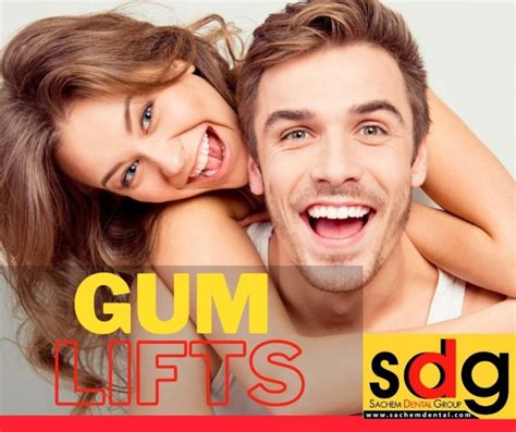 The Gum Lift Procedure - Sachem Dental Group