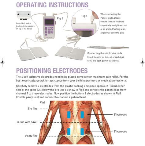 TENS Machines for Labour Pain