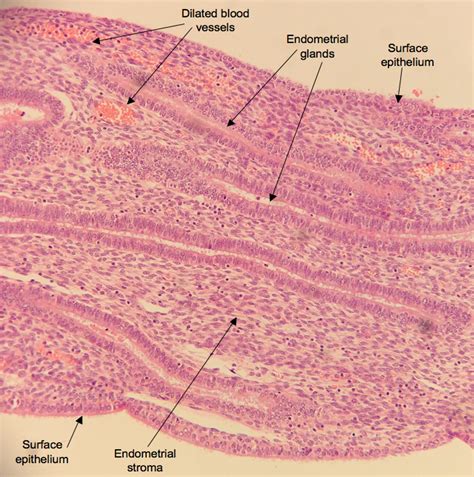 HistoQuarterly: ENDOMETRIUM | Histology Blog