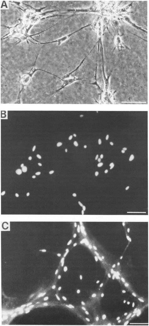 Light micrographs oftransfected Schwann cells. (A) Transfected Schwann... | Download Scientific ...