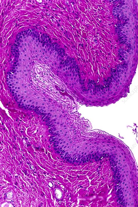 Stratified squamous epithelium - Stock Image - C016/0534 - Science Photo Library