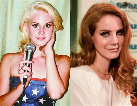 Lana Del Rey Plastic Surgery Before and After | Celebie