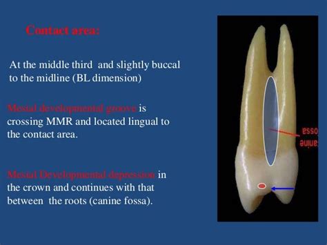 Maxillary premolars