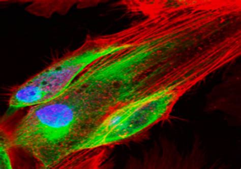 Powerful Integration of Fluorescence and Stereology: FluoroStereologer