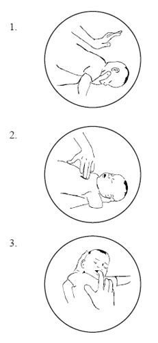 MCFRS Public Education - Infant Heimlich Manuever