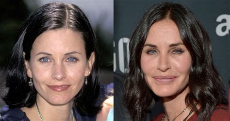 Courteney Cox | Plastic Surgery Disasters | Purple Clover