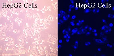 HepG2 Cell Culture - HepG2 Transfection