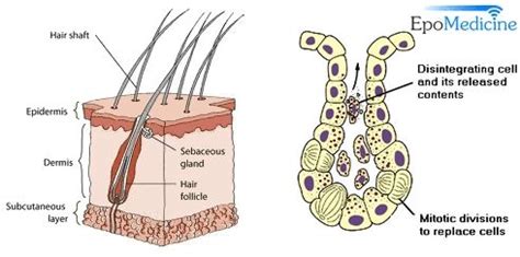 Pin on Sebaceous glands