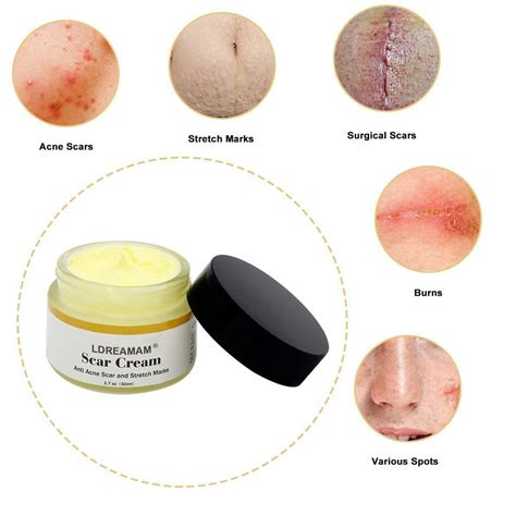 Acne Scar Removal Cream,Scar Cream,Scar Gel,Skin Repair Cream,Treatment for FaceBody Scar,Acne ...