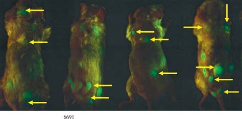 Figure 1 from Fluorescence imaging of multiple myeloma cells in a ...