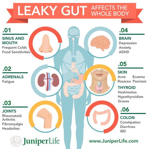 Leaky Gut Syndrome – Its More Common Than You Think – Mike Butler Fitness