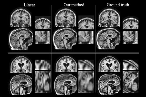 How To Get A Brain Scan - The mri scan at your scanning centre chosen ...