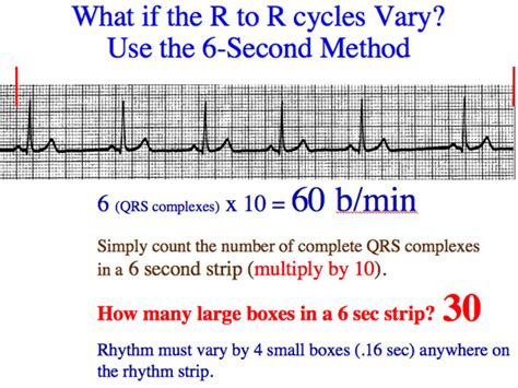 Ekg Heart Rate