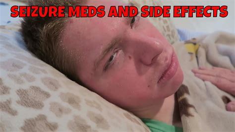 SEIZURE MEDS AND SIDE EFFECTS - YouTube