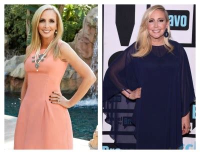 'Real Housewives of Orange County' Star Shannon Beador Sparks Plastic Surgery Rumors — See Her ...