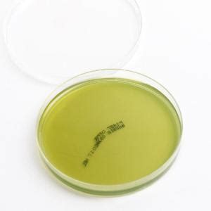 Hektoen Enteric Agar, Plates, Northeast Lab Services | VWR