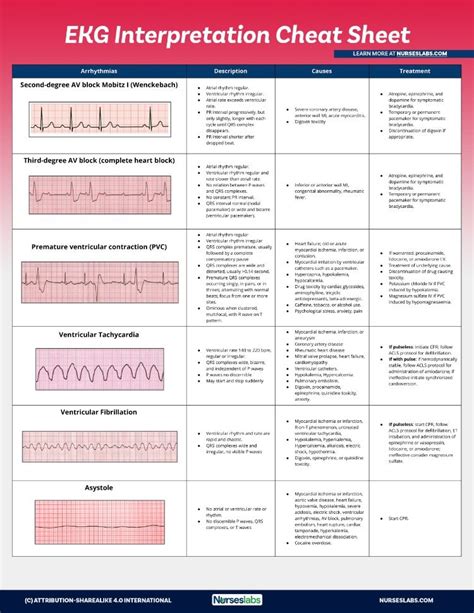 EKG Interpretation Cheat Sheet (Free Download) | Ekg interpretation ...