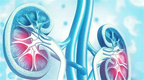 Enfermedad Renal Crónica: Causas, Síntomas y Tratamientos