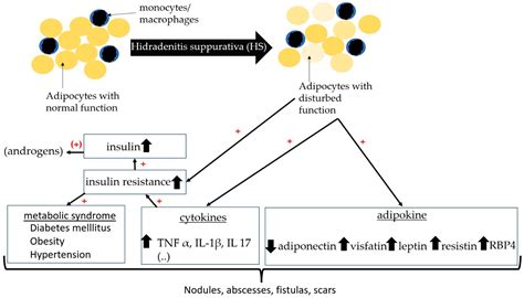 IJMS | Free Full-Text | The Role of Hormones in Hidradenitis ...