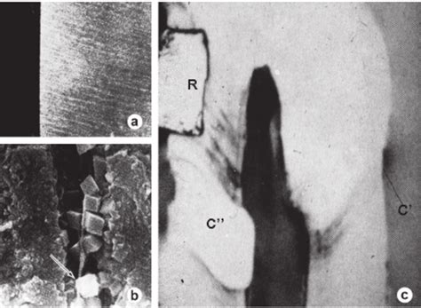 Different types of branching of dentinal tubules. Fig.10a is from a ...