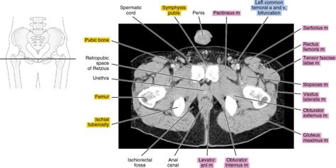 Male Pelvis Anatomy Ct | My XXX Hot Girl