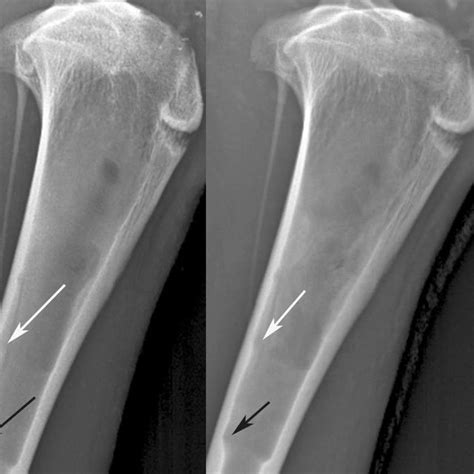 Photomicrograph of displaced bone chips, some of which appeared viable ...