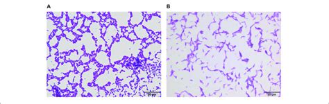 | Morphology of Lactobacillus fermentum CQPC04 (A) and Lactobacillus ...