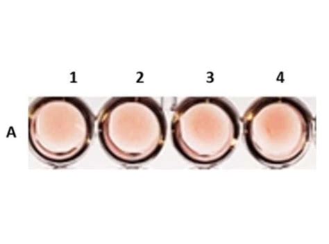 Novus Biologicals Sheep Hemagglutination Assay Kit 1 Kit:Protein Analysis | Fisher Scientific