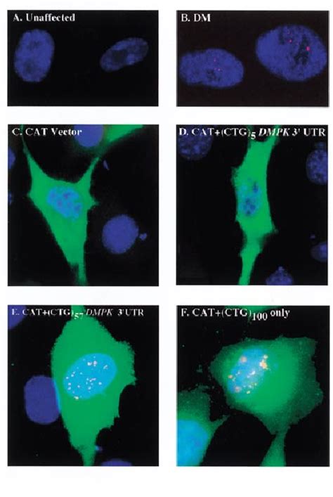 Nuclear RNA foci formation. RNA-FISH analysis with a CY3 fluorescently ...