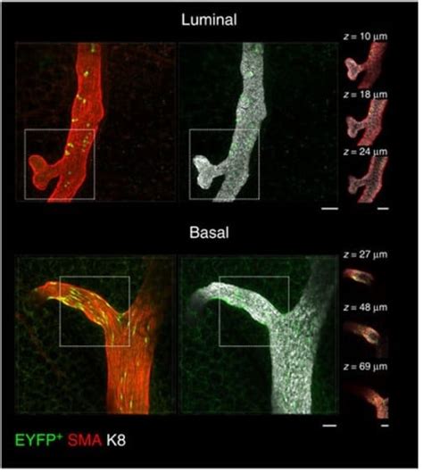 Anti-alpha smooth muscle Actin antibody [1A4] KO Tested (ab7817) | Abcam