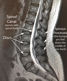 MRI Cervical Spine With Flexion and Extension | Mri Scan Images | Mri Scans | Pinterest ...