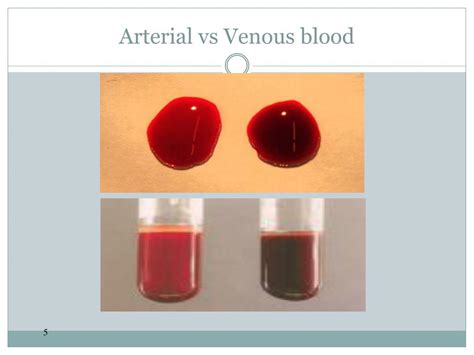 Arterial Blood Vs Venous Blood Color