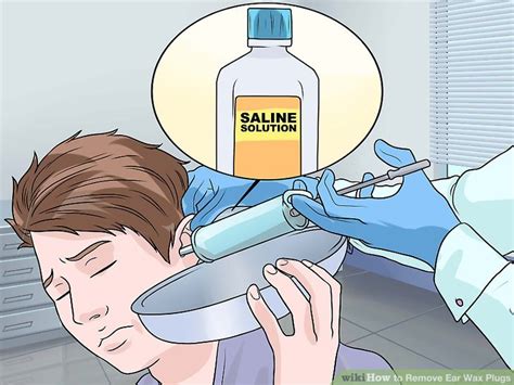 How to Remove Ear Wax Plugs (with Pictures) - wikiHow