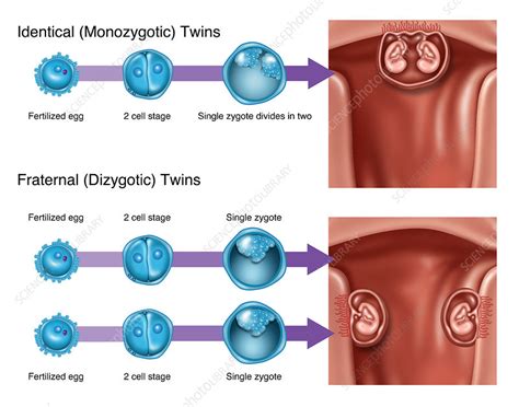 Development of Twins, Illustration - Stock Image - F031/8262 - Science Photo Library