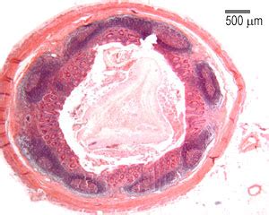 Histology Of Appendix