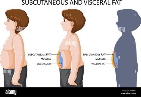 Visceral Muscle Diagram