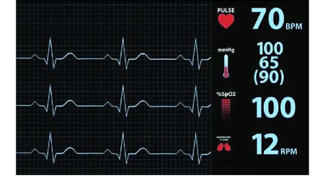 The Normal Heart Rating - bramapetro