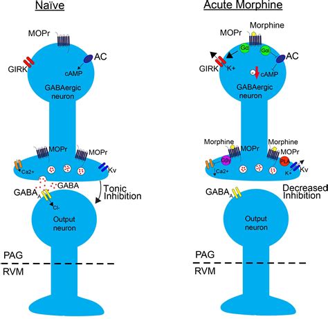 Addressing opioid tolerance and opioid‐induced hypersensitivity: Recent developments and future ...